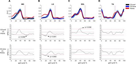 Gait Cycle Muscle Activity