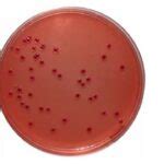 Yersinia Selective Agar Archives Universe84a