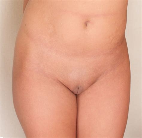 Lot Of V Rockets Porn Pic