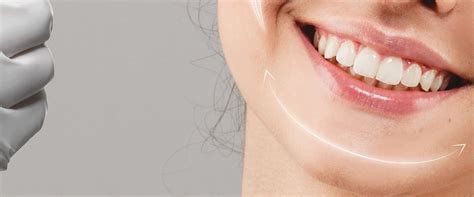 How Long Does A Restylane Syringe Last