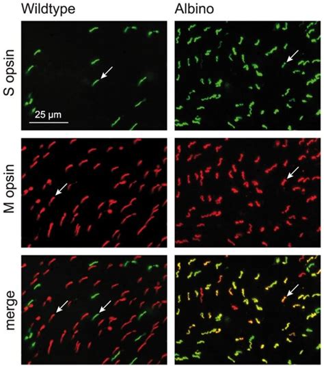 Double Immunofluorescence Labeling For S And M Opsin In Flatmounted