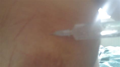 Scottish Slut Self Harm Porn Pictures XXX Photos Sex Images 232310 PICTOA