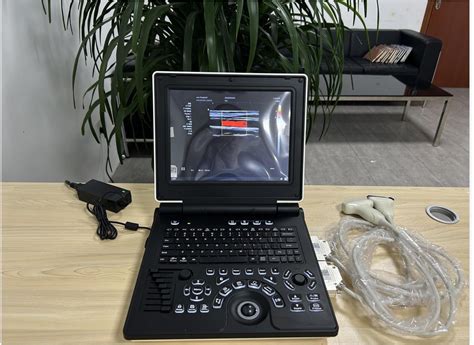 Portable Color Doppler Ultrasound Machine Laptop Ultrasound Scan