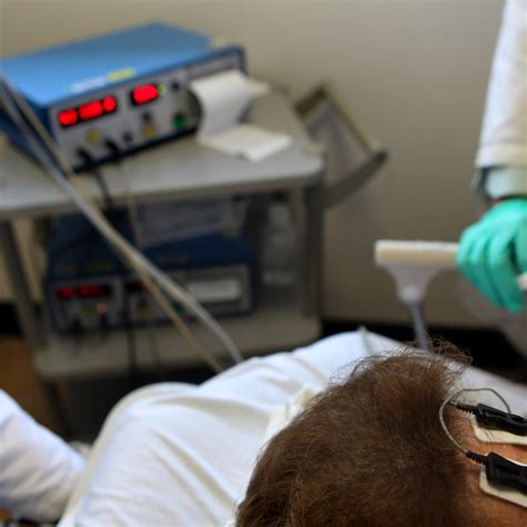 Brain Shocks For Depression