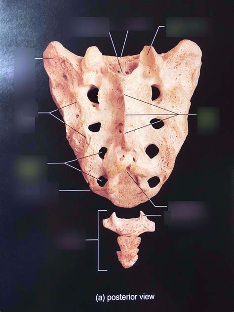 Posterior Sacrum Diagram Quizlet