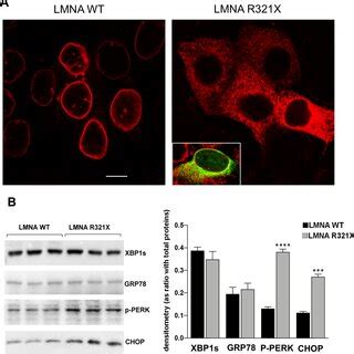 Expression Of WT And R321X LMNA In HL 1 Cardiomyocytes A Confocal