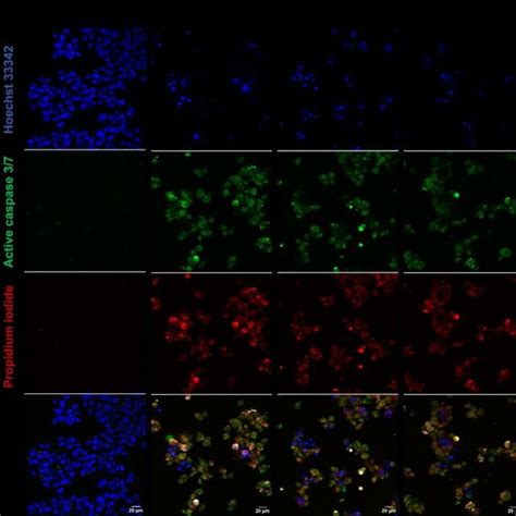 Fluorescent Microscopy Images Of Hepg Cells Treated With Vorinostat