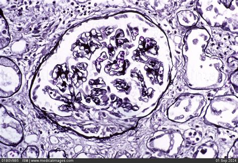 stock image photomicrograph   normal kidney glomerulus showing