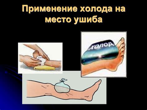 Механические повреждения - online presentation