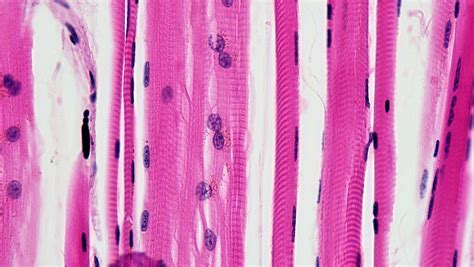Muscle Tissue: Skeletal Muscle Fibers | Cross section: tease… | Flickr