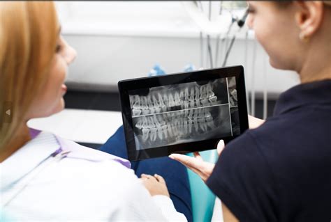 Why Are Dental X Rays Important Solar Dental And Orthodontics