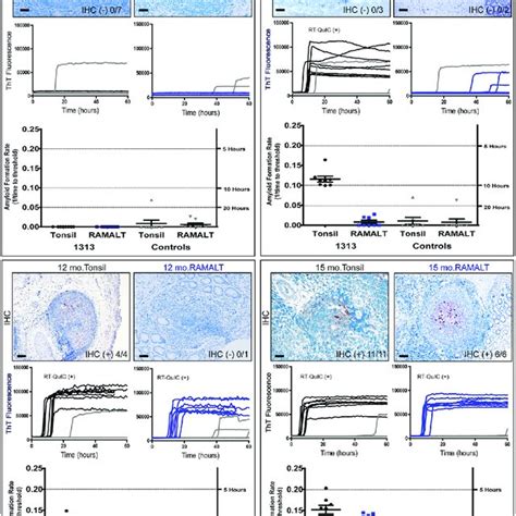 Rt Quic Seeding Activity Precedes Ihc Detection Of Prp Cwd In Tonsil