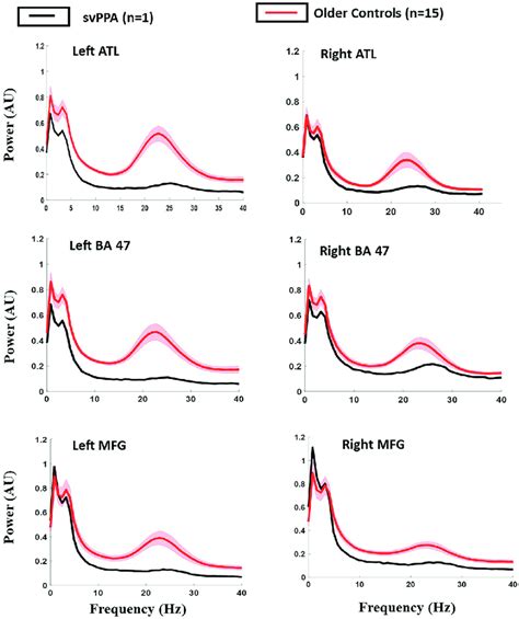 Resting State Power Spectra Plots For P08 And Older Controls Oc In