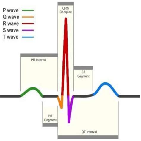 Schematic representation of normal ECG | Download Scientific Diagram