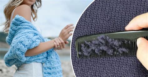 Как убрать катышки с зимней одежды: 5 способов, о которых вы не знали ...