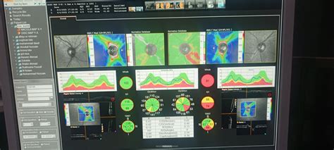 Ask a Eye Specialist Online for Issue Left Eyes Blindness