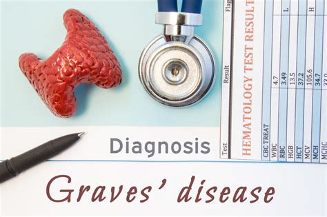 Graves Disease Do These Symptoms Sound Familiar University Health News