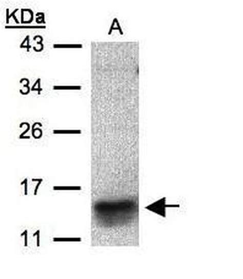 Ccl1 Polyclonal Antibody Pa5 21941