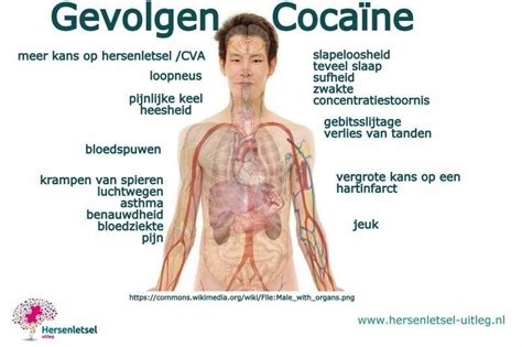 Hersenletsel Door Drugs Vergiftiging En Middelengebruik Soorten