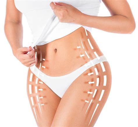 Body Contouring New Life Body Sculpting