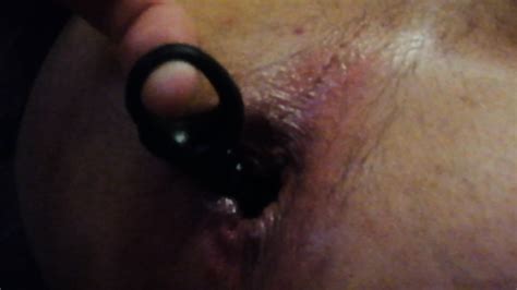 Huge Anal Plug Tore Anal Sphincter