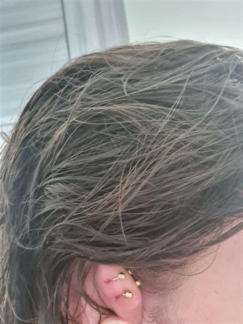 Piercing Migration What Should I Do Rpiercing