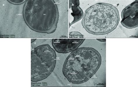 Tem Micrographs Obtained From C Albicans Atcc 14053 Cells Grown In The