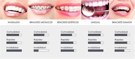 ¿qué Tipo De Ortodoncia Elijo Diferencias Alvarado Dental Clinic