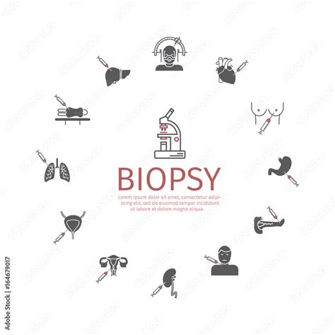 Biopsy: Types of biopsy procedures used to diagnose cancer Stock Vector ...