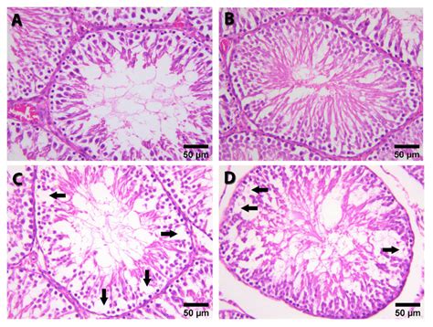 Morphological Appearance Of Testicular Tissue Obtained From Different