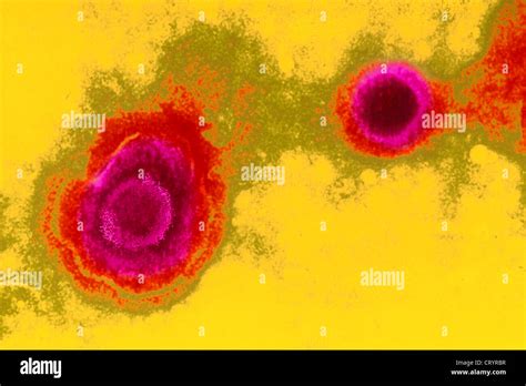 Herpes Simplex Virus Stock Photo Alamy