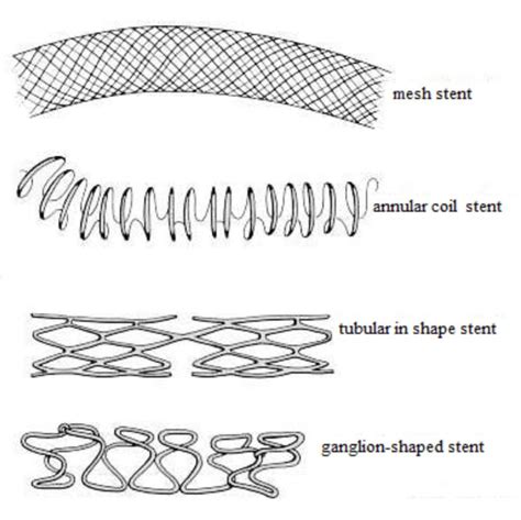 stent   implantation seyyed reza miri md