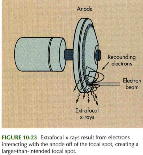 The X Ray Tube Flashcards Quizlet