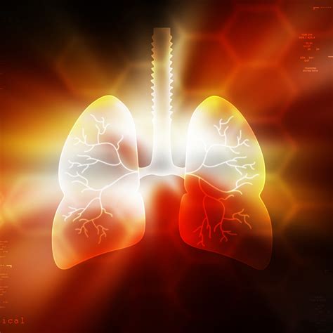 The Conundrum of Open Lung Biopsy in Critically Ill Patients | 2015-12-16 | AHC Media ...