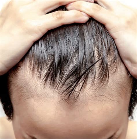 Common Hair And Scalp Problems Examples And Solutions Hair Doc