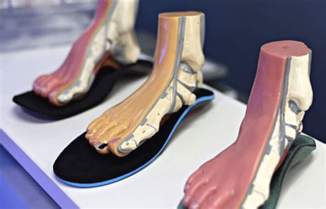 Custom Orthotics For Cushioning Stability Support