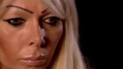 Plastic Surgery Milf Auditions For T V Show Babe Porn Xhamster