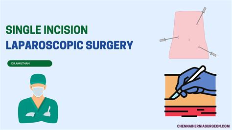 Single Incision Laparoscopic Surgery How It Works