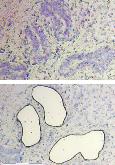 Representative Figures Of Mammary Parenchymal Tissues Before And After