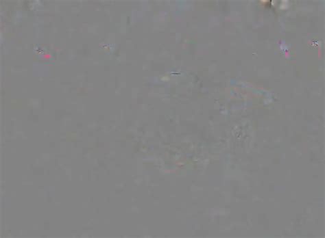 Cam Girl Anal Speculum By M D F