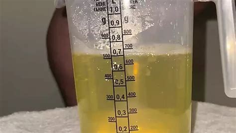 Foreskin Filled With Cum From Big Cock With Screams Russian Gay Amateur Porn Xhamster