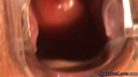 Speculum Babe Gapes Cunt With Speculum Before Cum On Pussy