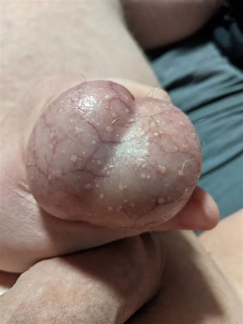 Ball Pictures 3 My Balls Hurting 20 Nude Pics XHamster