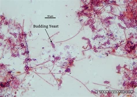 Yeast Gram Stain Morphology