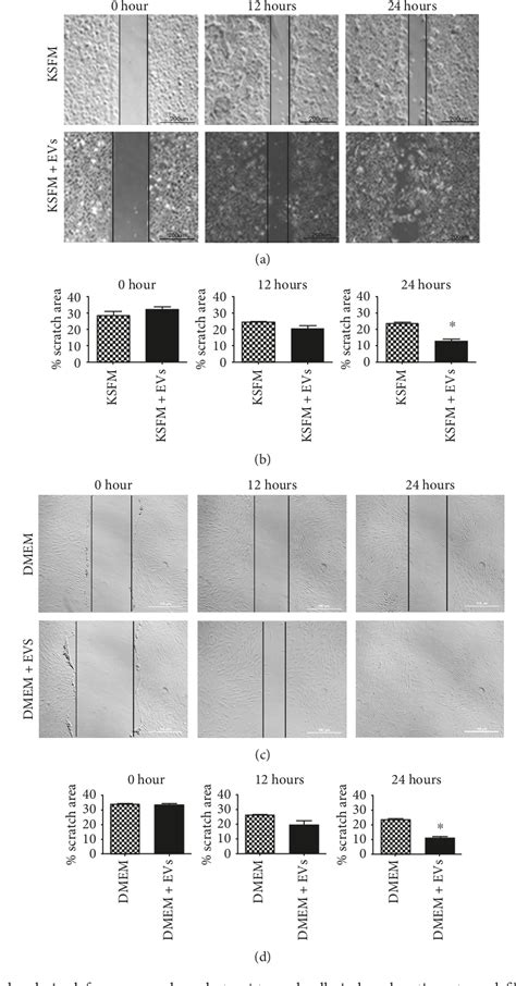 Figure From Extracellular Vesicles From Adipose Derived Mesenchymal