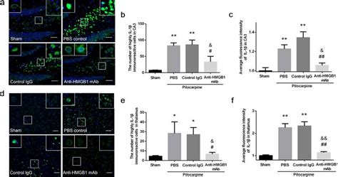 Expression of IL-1β in the CA3 hippocampal region and the thalamus of ...