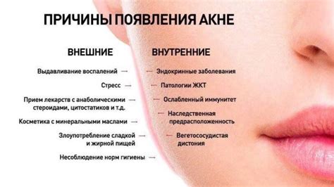 Прыщи на подбородке у женщин: причины постоянных прыщей, лечение