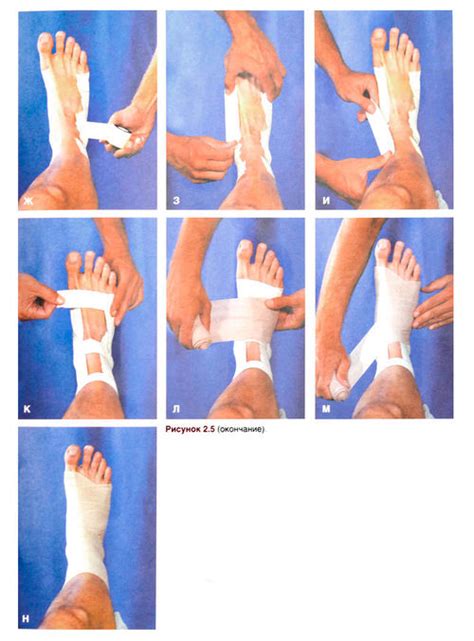 Повреждения и травмы связок голеностопного сустава — SportWiki энциклопедия