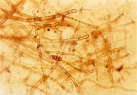 Difference Between Septate And Aseptate Hyphae Compare The Difference