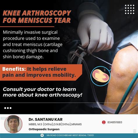Dr. Santanu Kar - Discover how knee arthroscopy...